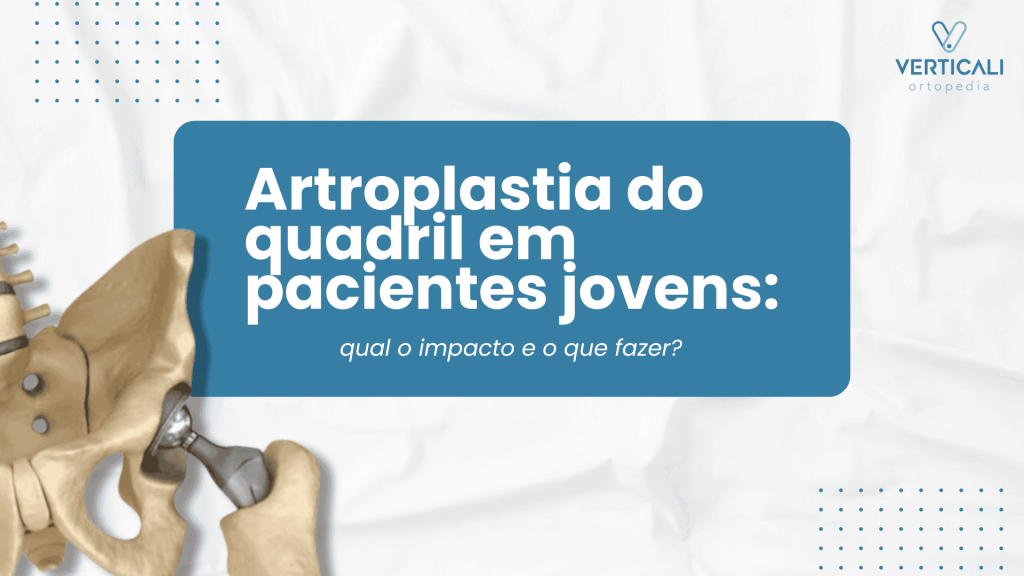 Artroplastia do quadril